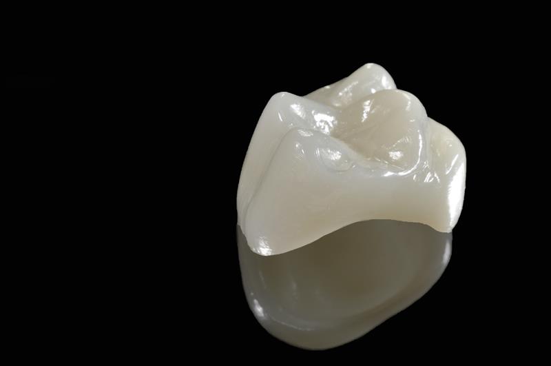 Coronas individuales y Prótesis fija (Metal porcelana * E-max * Zirconio)