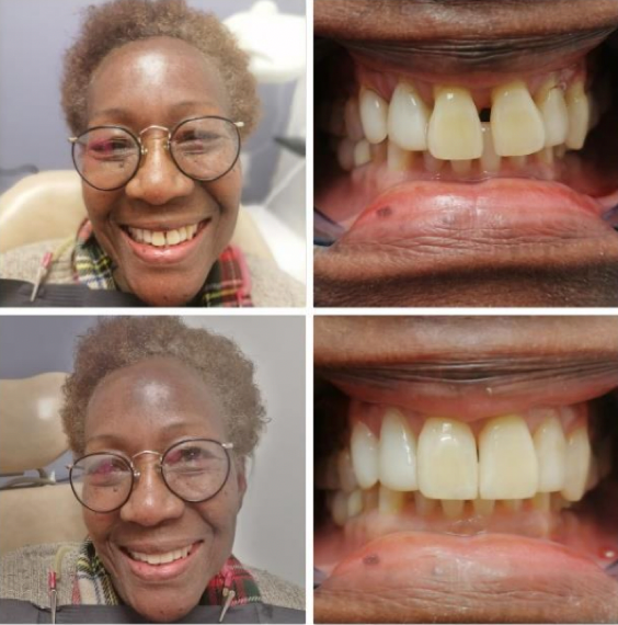 Odontología Estética