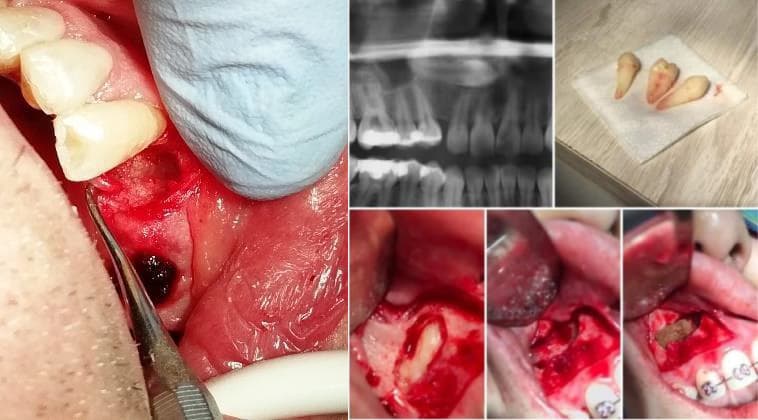 Cirugía Maxilofacial y Ortognática