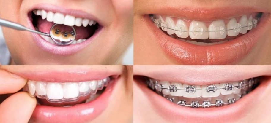 Ortodoncia y Ortopedia Maxilofacial